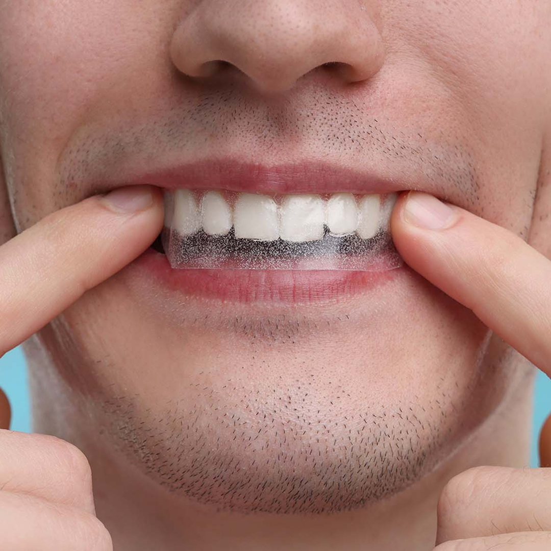 Teeth Whitening Strips - 3 Stk.